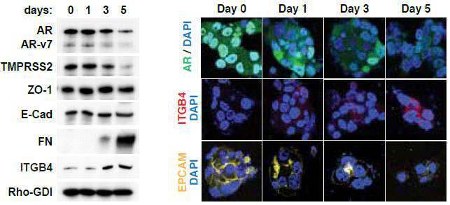 VCaP enzalutamide time-series in vitro. (left) Western blot of AR, AR-v7, AR target gene TMPRSS2, EMT and stemness markers. (right) immunofluorescence staining of AR, ITGB4 and EpCAM in enzalutamide-treated VCaP cells