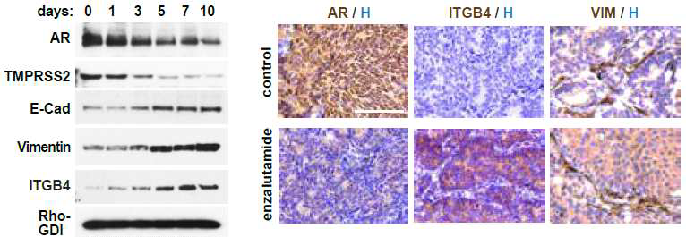 MDA-PCa-163A enzalutamide time-series in vitro (left) and in vivo (right)