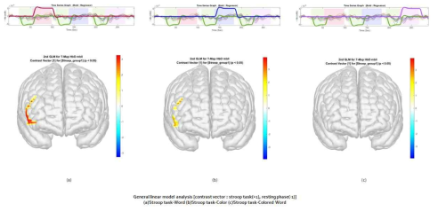 GLM (general linear model) analysis를 시행한 결과