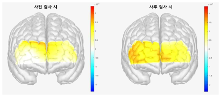 스트룹 – 단어 검사 시 모바일 뉴로피드백군의 뇌 혈류량 비교
