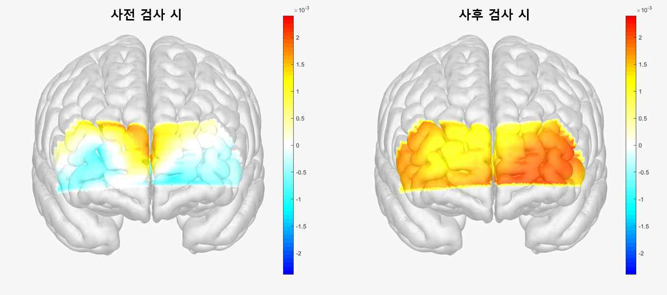 스트룹 – 단어 검사 시 샴 대조군의 뇌 혈류량 비교