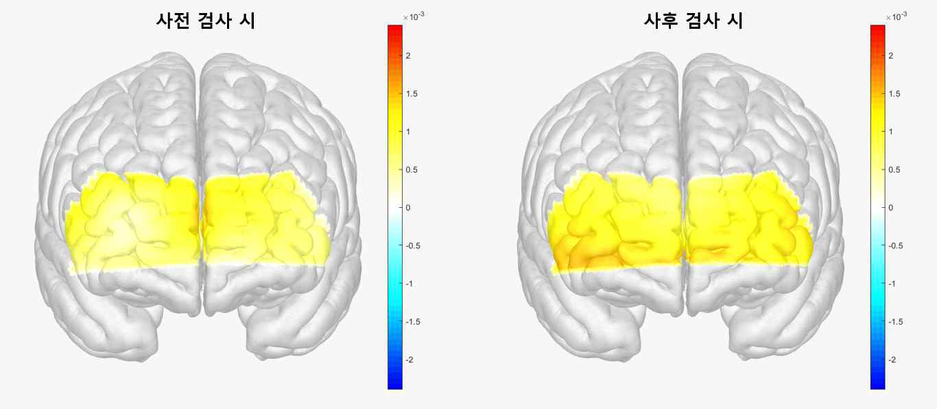 스트룹 – 색상 검사 시 샴 대조군의 뇌 혈류량 비교
