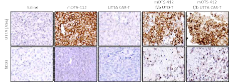 UTTA의 발현 및 인간 T 세포의 종양 내 분포