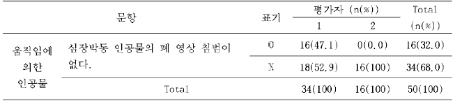 심장박동 인공물의 펴1 영상 침범