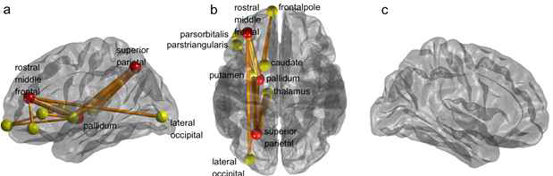 자살사고에 따른 whole brain mapping of connectivity