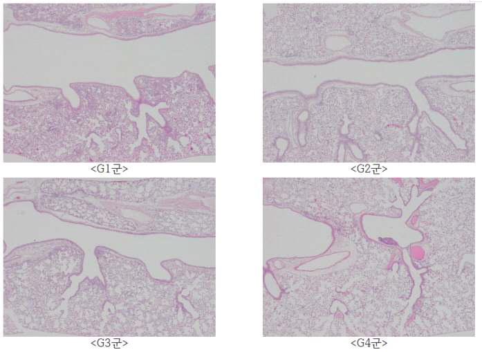 바이러스 접종 후 6일차 비강 투여군에서 채취한 폐 조직의 슬라이드