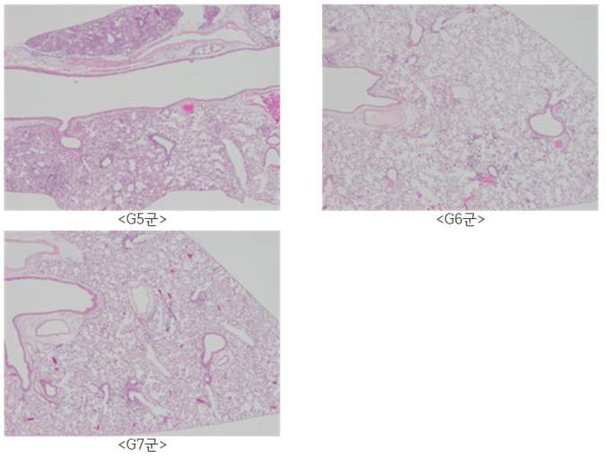바이러스 접종 후 6일차 복강 투여군에서 채취한 폐 조직의 슬라이드