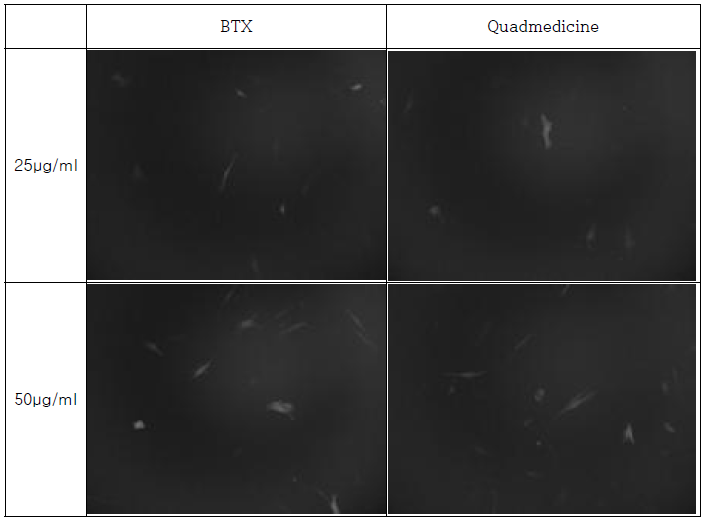 BTX, Quadmedicine 펄스 발생기를 이용한 전기천공법 적용 뒤 24시간 Cell incubation 후 DNA 농도에 따른 GFP 발현 형광 이미지