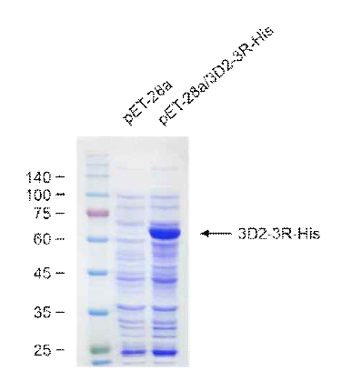 pET-28a/3D2-3R-His 벡터가 형질전환된 재조합 Rosetta2 세포에서 재조합 3D2-3R-His 단백질의 발현을 확인함