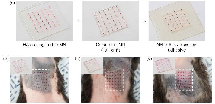 (a) 동물실험용 마이크로니들 제작 과정, (b-d) 각각 2분, 10분, 30분간 실험동물 피부 내 마이크로니들 삽입 후 제거한 결과