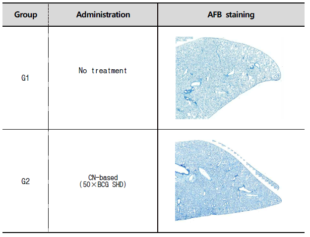 기니피그의 폐조직(AFB staining)