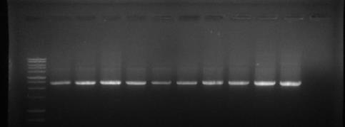 IGS1 region을 PCR 증폭하고 아가로즈 겔에 전기영동한 결과