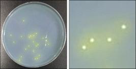 Clear zones of proteolytic strains on BCP plate count skim milk agar by lactic acid bacteria