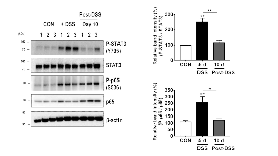 DSS에 의한 염증성 대장염 유도 마우스에서의 STAT3 및 NFkappa-B 활성 변화