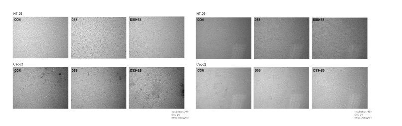 죽순, 사철쑥 복합추출물 및 DSS 처리에 의한 세포 모양 변화