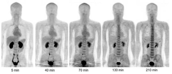 정상인에서 [18F]FMT 투여 이후 시간에 따른 PET 영상 변화