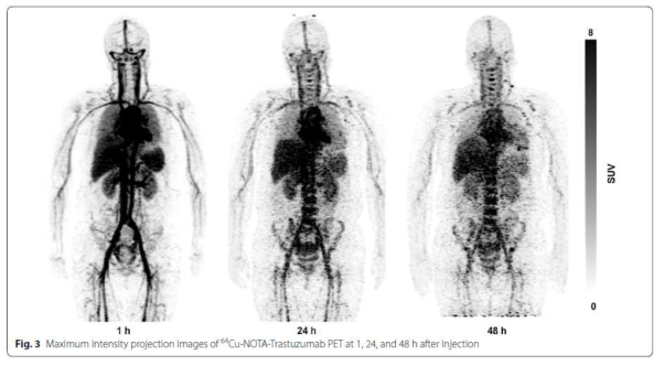 유방암 환자에서 [64Cu]NOTA-Trastuzumab 투여 이후 시간에 따른 PET 영상 변화 ※ 이 연구결과는 Lee, et al. 