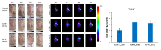 Cu-64 생체분포 영상. 사람신경교종세포(U87MG-L)와 구리수송체유전자 발현 사람신경교종세포(U87MG-L-hCTR1) 이식 종양 마우스 모델에서 Cu-64 주사 후 24시간에 PET 영상획득. 구리수송체유전자 발현 종양에서 대조군보다 약 1.7배 높은 Cu-64 섭취율을 보였음