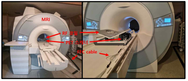MRI내부에 개발된 PET 스캐너 시제품이 삽입된 모습