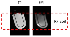 PET 삽입시 MRI T2(좌) 및 EPI(우) 영상