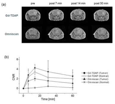 Gd-TDAP의 MR 영상 및 뇌 영역의 신호변화
