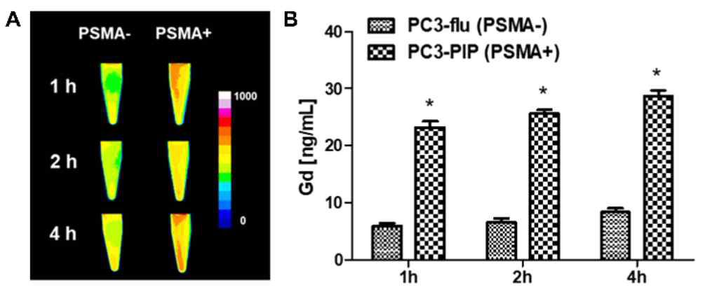 PSMA +/- 세포에 대한 Gd-FC705의 축적률 비교