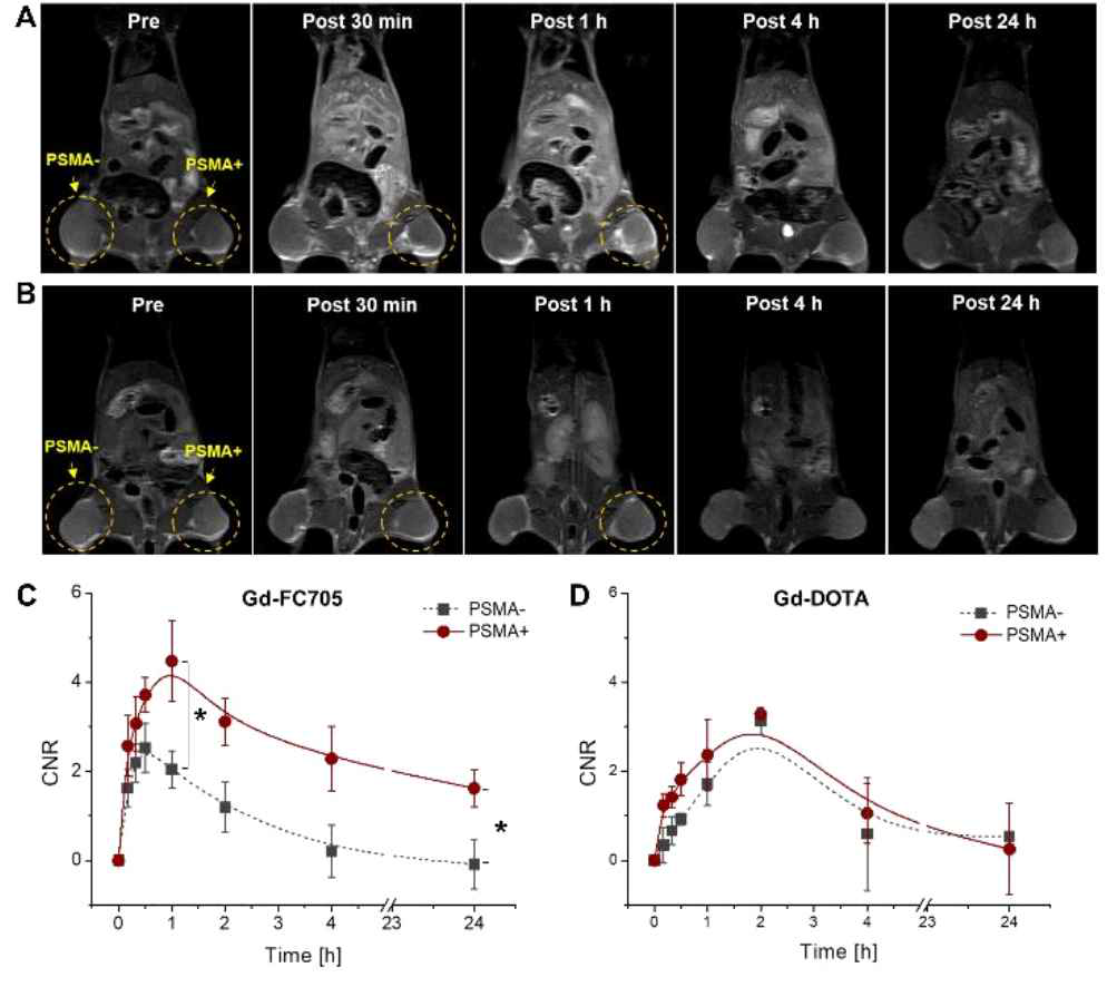 PSMA +/- 종양에 대한 Gd-FC705의 MR 영상 및 신호 비교