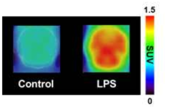 방사성리간드를 미정맥 주사한 후 얻은 대조군과 LPS 처리군의 dynamic 뇌 PET 영상