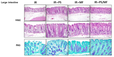 방사선 위장관 손상 미니피그 모델에서 pravastatin (PS)와 metformin (MF) 적용에 따른 대장의 조직학적 변화