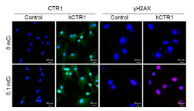 U87MG 및 U87MG-hCTR1 세포에서 Cu-64 (0.1 mCi) 처리에 따른 DNA 손상 정도 비교. 면역형광염색에서 hCTR1 발현이 관찰된 U87MG-hCTR1 세포에서 Cu-64 처리 후 γH2AX foci가 관찰되었음