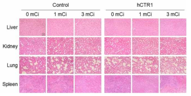 종양 마우스 모델에서 Cu-64 투여 후 주요 장기의 H&E 염색 분석. 대조군과 U87MG-hCTR1 종양 마우스 모델 모두 Cu-64 투여에 따른 독성이나 특이적인 손상은 없는 것으로 나타났음