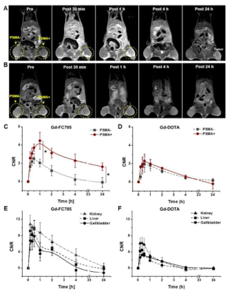 Gd-FC705의 PSMA(+/-) MR영상 및 각 장기별 신호 변화