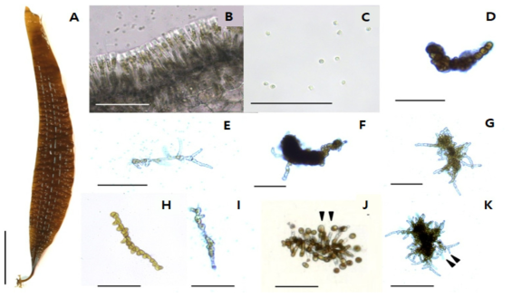 Procedure of the isolation and culture of free-living gametophytes of Saccharina sculpera. A, Mature sporophyte; B, A cross-section of sporangia; C, Germling after zoospore release; D, Female gametophyte after 5 days culture; E, Male gametophytes after 5 days culture; F, A cluster of female gametophyte after 20 days culture; G, A cluster of male gametophyte after 20 days culture; H, A fragment of female gametophyte; I, A fragment of male gametophyte; J, Oogonia formation (arrowheads) after 15 days maturation induction from a female gametophyte fragment; K, Spermatia formation (arrowheads) from a male gametophyte fragment. Scale bar are 10 cm (A), 100 μm (B-C), 50 μm (D-E), 1 mm (F-G), 50 μm (H-I) and 100 μm (J-K)