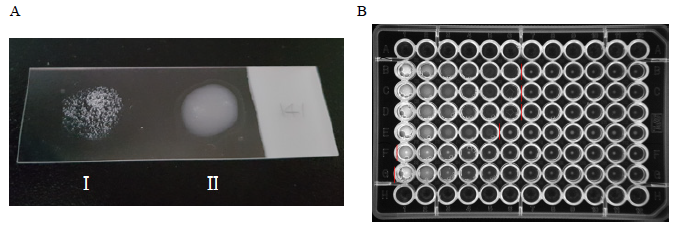 Serotyping method of S. parauberis in this study. A, slide agglutination test; B, microtiter test