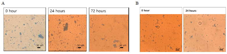 Stability of liposome oral vaccine prototype in sea water (A) and distilled water (B)