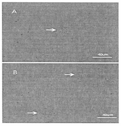 저산소상태에 노출된 부착성 cyst. Arrow, 부착성 cyst; A, 노출3일 B, 노출 5일