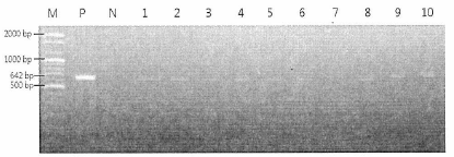 Azumiobodo hoyamushi PCR 검사. M,marker; P, positive control; N, negative control, Lane 1-10, sample