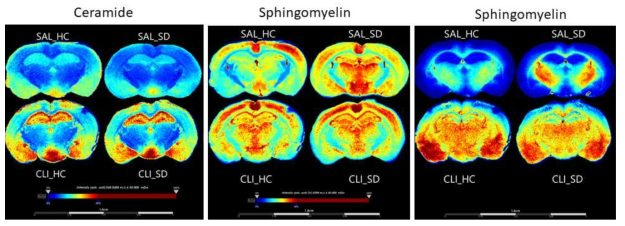 우울증마우스모델 뇌에서의 처리구별 lipid 질량분석이미징