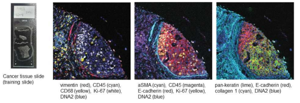 Cancer tissue imaging