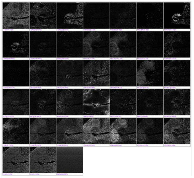 Imaging Mass Cytometry