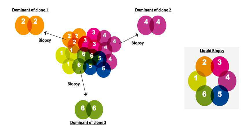 Liquid Biopsy