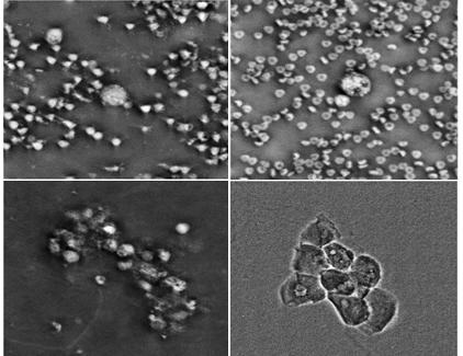 Differential phase contrast 기반 Computational microscopy로 촬영한 혈액 내 적혈구 및 암세포의 위상 영상