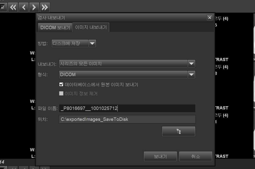 PACS 영상 데이터 추출