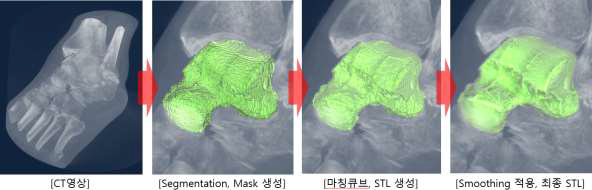 영역분할 알고리즘을 사용한 3D 모델링 모식도