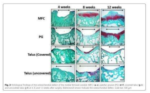 거골부위 골결손 모델의 조직학적 분석 참고문헌: Makitsubo, M., et al. (2016). 