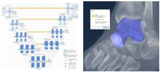CNN 기반의 V-net 구조(좌), 자동 발목관절 영역분할 결과(우)