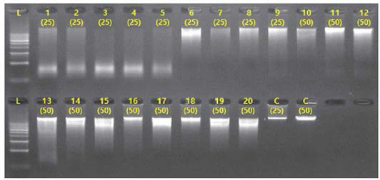 DNA 전기영동 확인결과(1차) 1~5； 북방산개구리，6~10; 한국산개구리，11~15; 큰산개구리，16~20; 계곡산개구리