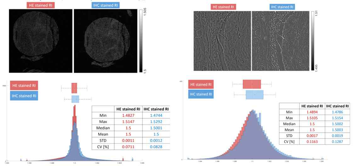 H&E 염색 슬라이드의 굴절률(RI)와 면역조직화학(IHC) 염색 슬라이드의 굴절률(RI)
