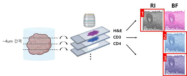 암조직 H&E 염색, 바이오마커 면역조직화학(IHC) 염색 슬라이드의 굴절률(RI) 확보