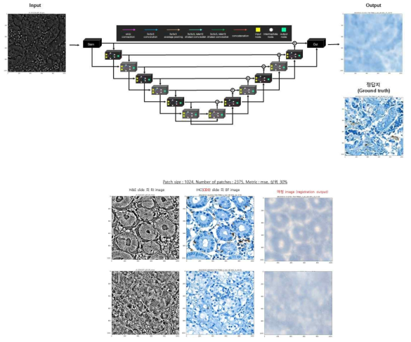 H&E 슬라이드의 굴절률(RI) 영상, IHC 슬라이드의 명시야(BF) 영상 알고리즘 매칭